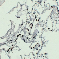 ACP5 antibody