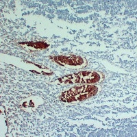 Anti-Villin Antibody