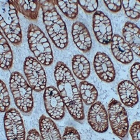 Anti-Villin Antibody