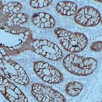 Villin Mouse Monoclonal Antibody