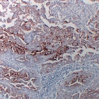Anti-MUC16 Antibody