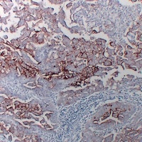 MUC16 antibody