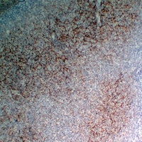 CD35 Antibody