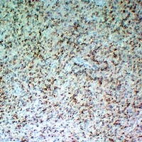CD5 Mouse Monoclonal Antibody