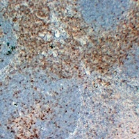 Anti-CD5 Antibody