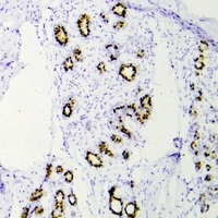 Anti-CD5 Antibody