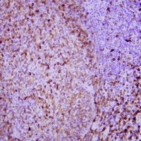 CD74 Mouse Monoclonal Antibody