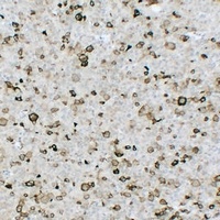 FSH beta Antibody