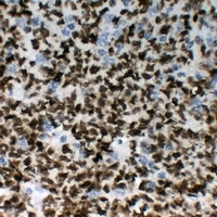 Anti-OCT2 Antibody