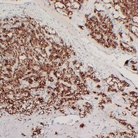 PTH Mouse Monoclonal Antibody