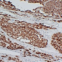 PTH Mouse Monoclonal Antibody