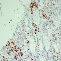 Prolactin Mouse Monoclonal Antibody