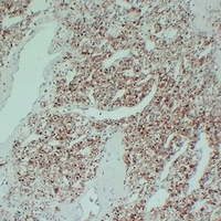 S100-A1 Mouse Monoclonal Antibody