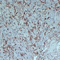 Anti-S100-A4 Antibody