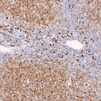 TCL1A Antibody
