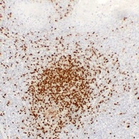 TCL1A antibody
