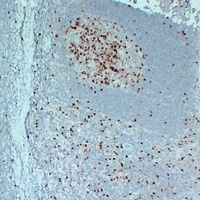 Topoisomerase 2 alpha Antibody