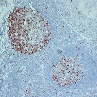 Topoisomerase 2 alpha Antibody