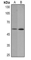 Vimentin Antibody