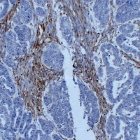 Vimentin Antibody
