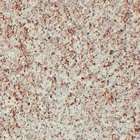 Vimentin Antibody
