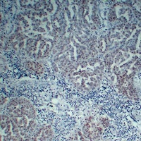Anti-Wilms Tumor 1 Antibody