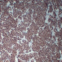Anti-Wilms Tumor 1 Antibody