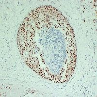 Estrogen Receptor alpha Mouse Monoclonal Antibody