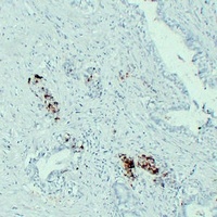 IGF2 Mouse Monoclonal Antibody