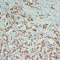 SOX9 Antibody
