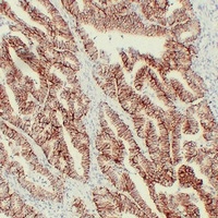 Anti-Claudin 7 Antibody
