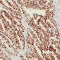 Claudin 7 antibody