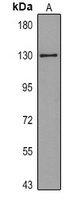 E Cadherin Mouse Monoclonal Antibody