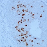 Mammaglobin-A/B Mouse Monoclonal Antibody