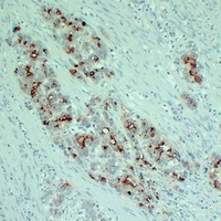 PI3K p110 alpha (H1047R) Antibody