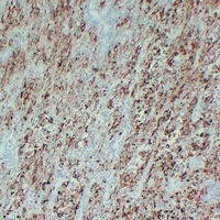 Anti-Tyrosinase Antibody