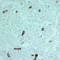 alpha Smooth Muscle Actin Antibody