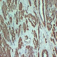 ACTA2 antibody