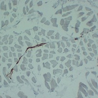 ACTA2 antibody