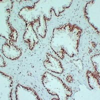 Androgen Receptor Mouse Monoclonal Antibody