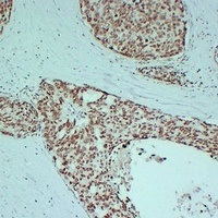 Androgen Receptor Mouse Monoclonal Antibody