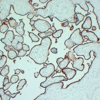 Anti-CD105 Antibody