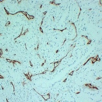 Anti-CD105 Antibody
