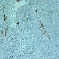 Anti-CD105 Antibody