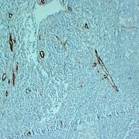 CD105 antibody