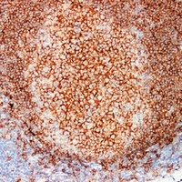 CD20 Antibody