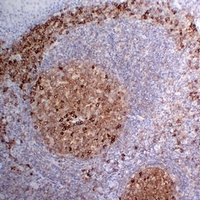 Anti-CD38 Antibody
