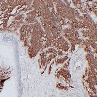 CD56 Antibody