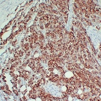 CD63 Antibody