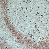 CD79a Mouse Monoclonal Antibody